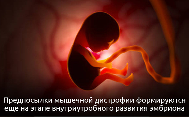 Формирование мышечной дистрофии на этапе развития эмбриона