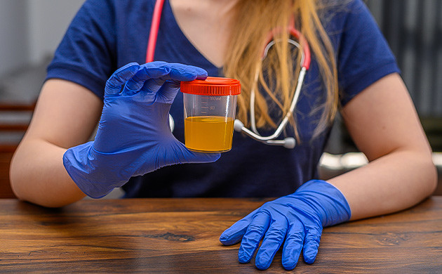 КБД тесты на наркотики