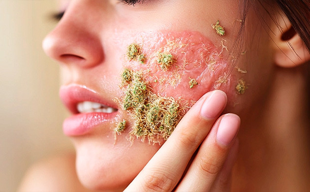 Неролидол против кожных заболеваний: факты и исследования Неролидол: союзник в борьбе за здоровую кожу